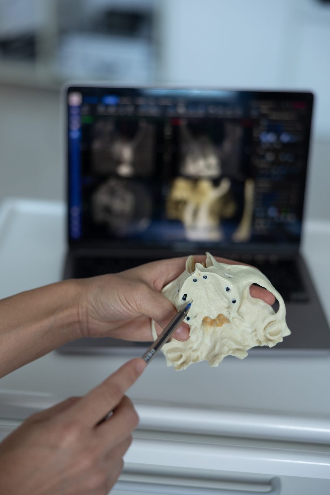 Lucrare de protetică dentară la clinica Dr Olga